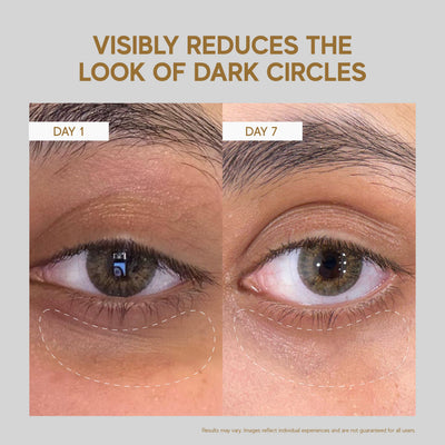 Luminary Eye Concentrate